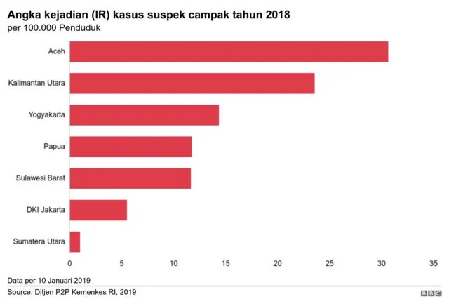 Kenaikan Kasus Campak Mendorong Pemerintah Percepat Vaksin MR Gratis, Stok Aman dan Teruji