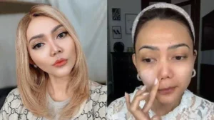 Rina Nose Akhirnya Ungkap Alasan 10 Tahun Menunda Operasi Hidung: Dari 'Trademark' hingga Pertimbangan Etis
