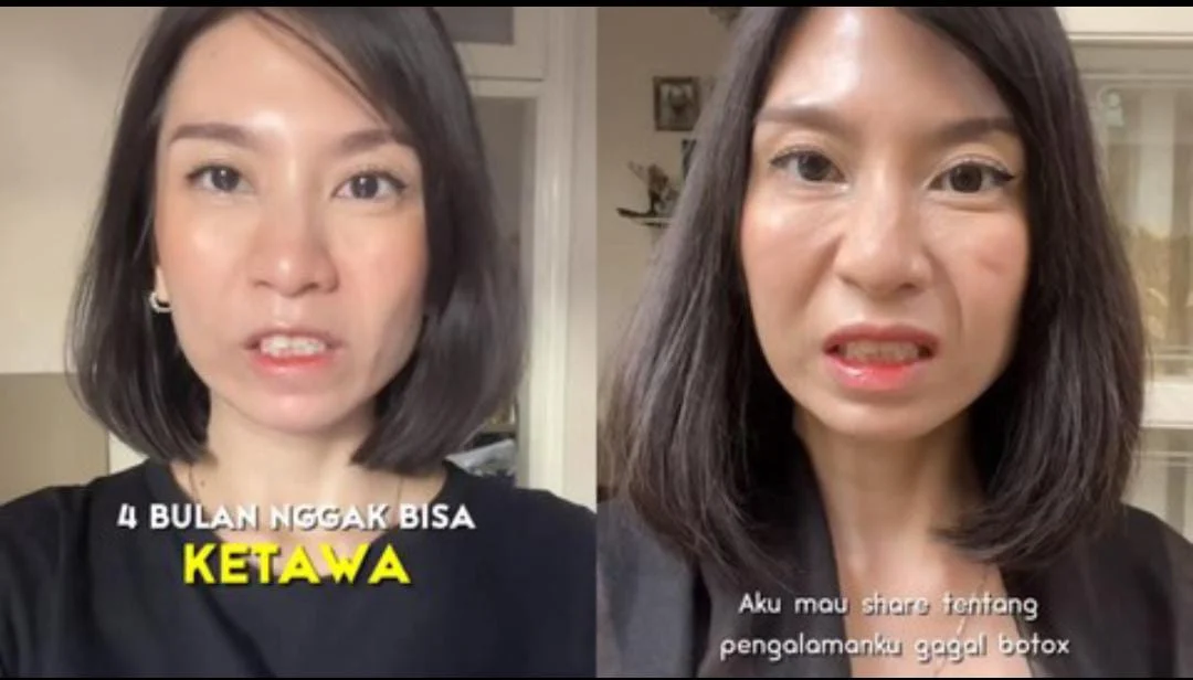 Wajah Kencang Karena Botox, Ratu Felisha Tersiksa Tak Bisa Tertawa di Tengah Syuting Film